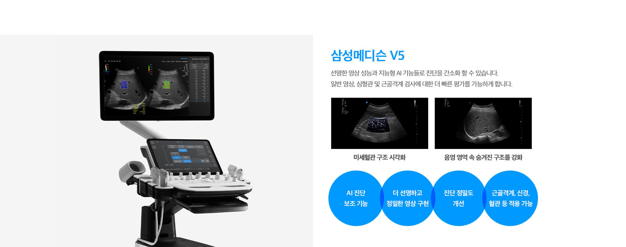 [삼성메디슨 V5] 선명한 영상 성능과 지능형 AI 기능들로 진단을 간소화 할 수 있습니다. 일반 영상, 심혈관 및 근골격계 검사에 대한 더 빠른 평가를 가능하게 합니다. (AI 진단 보조 기능 / 더 선명하고 정밀한 영상 구현 / 진단 정밀도 개선 / 근골격계, 신경, 혈관 등 적용 가능)