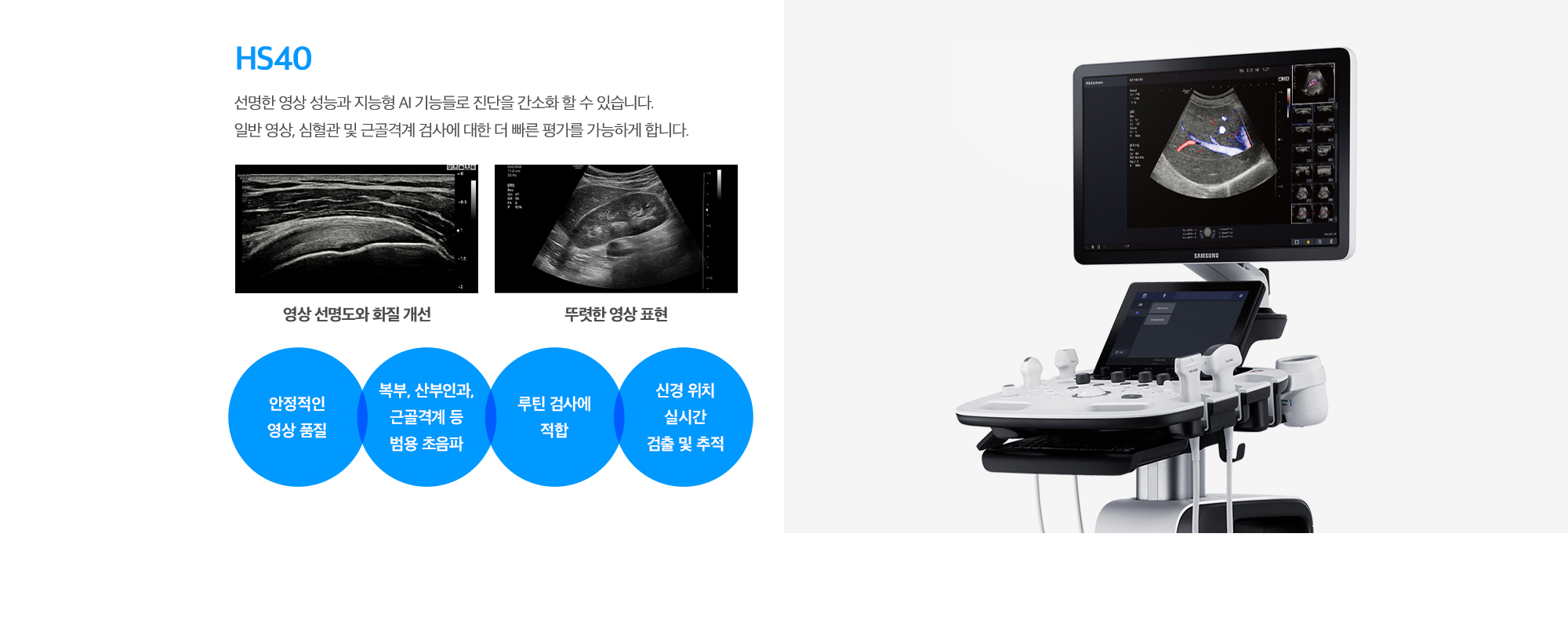 [HS40] 선명한 영상 성능과 지능형 AI 기능들로 진단을 간소화 할 수 있습니다. 일반 영상, 심혈관 및 근골격계 검사에 대한 더 빠른 평가를 가능하게 합니다. (안정적인 영상 품질 / 복부, 산부인과, 근골격계 등 범용 초음파 / 루틴 검사에 적합 / 신경 위치 실시간 검출 및 추적)